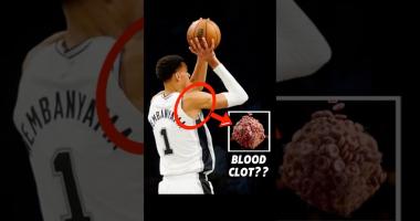 Spurs reportedly optimistic Wembanyama will return from blood clot issue next season