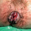 Disqus profile picture for @Gonorrhea